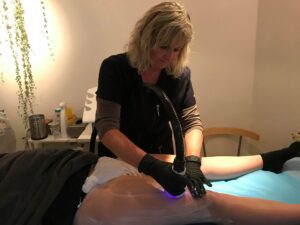 inge cryo 21